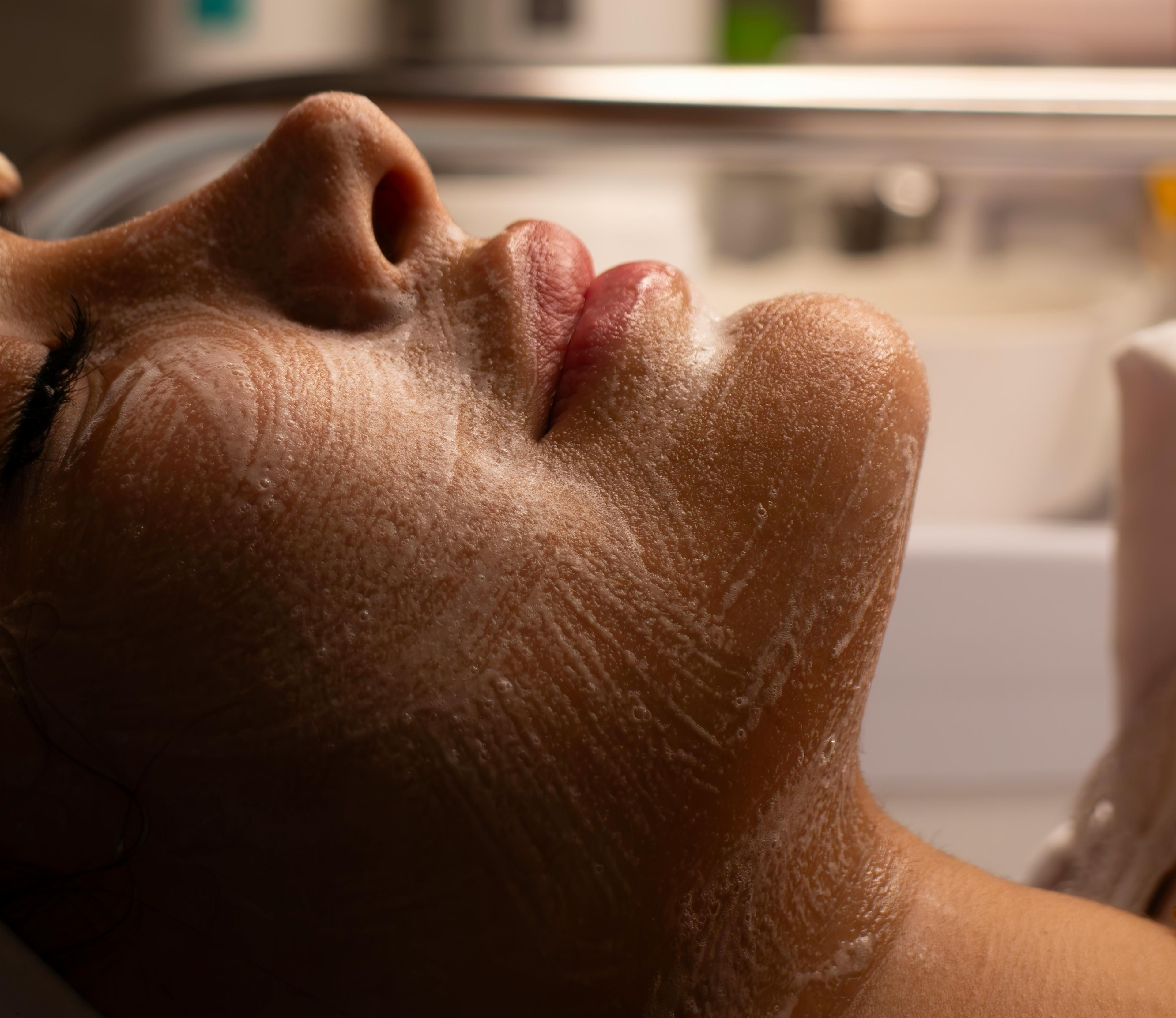 Mature woman skin with peeling during procedure